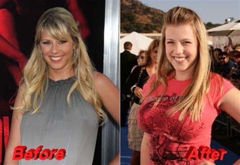 jodie sweetin boobs|Jodie Sweetin Plastic Surgery: Before and After Her Boob Job